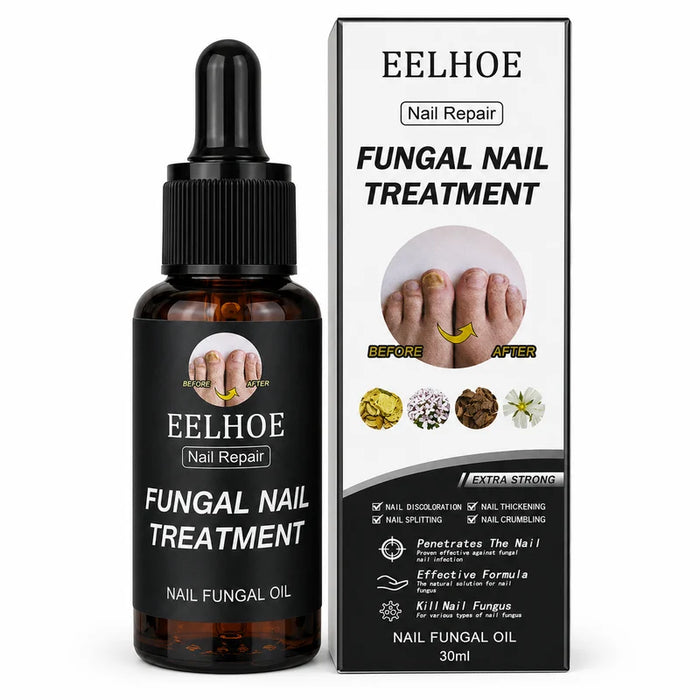 زيت EELHOE لإصلاح الأظافر وعلاج الفطريات
